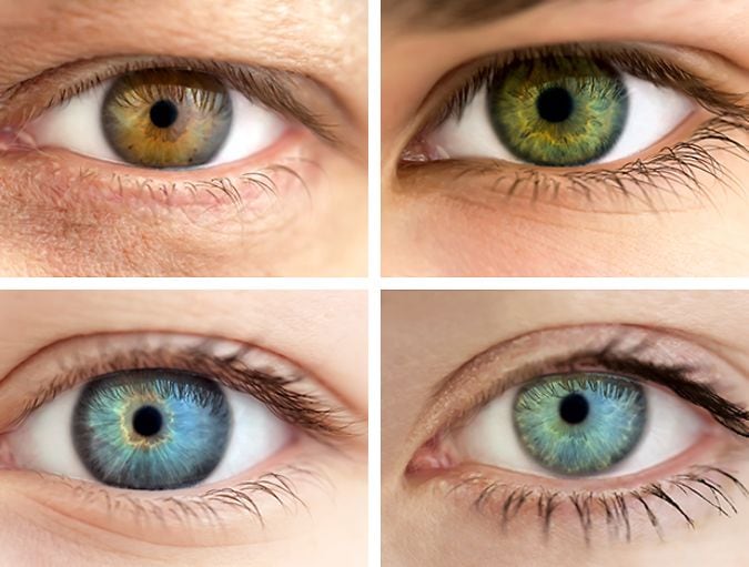 How_do_people_with_eye_diseases_see_the_world_row_1