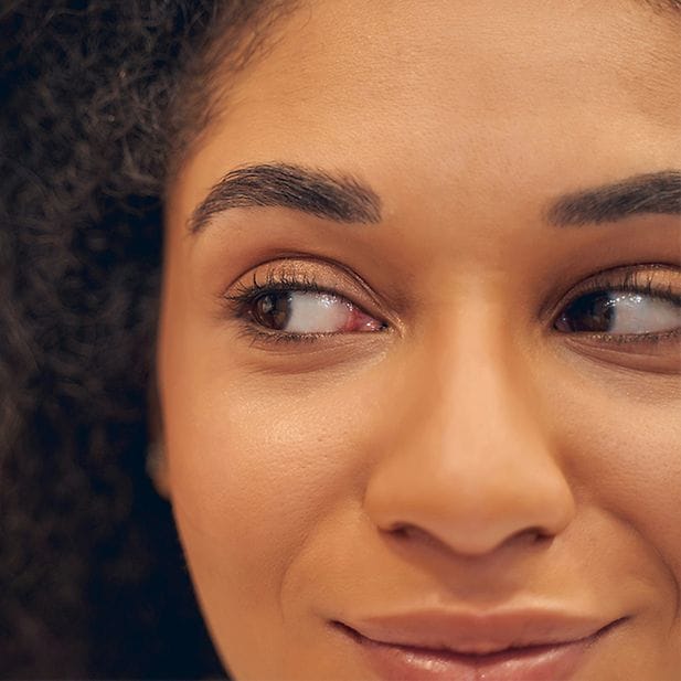 Gezicht van een vrouw die naar rechts kijkt en glimlacht.